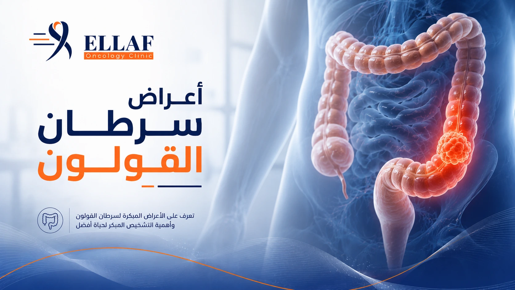 أعراض سرطان القولون | أهم العلامات المبكرة ومتى تستشير الطبيب