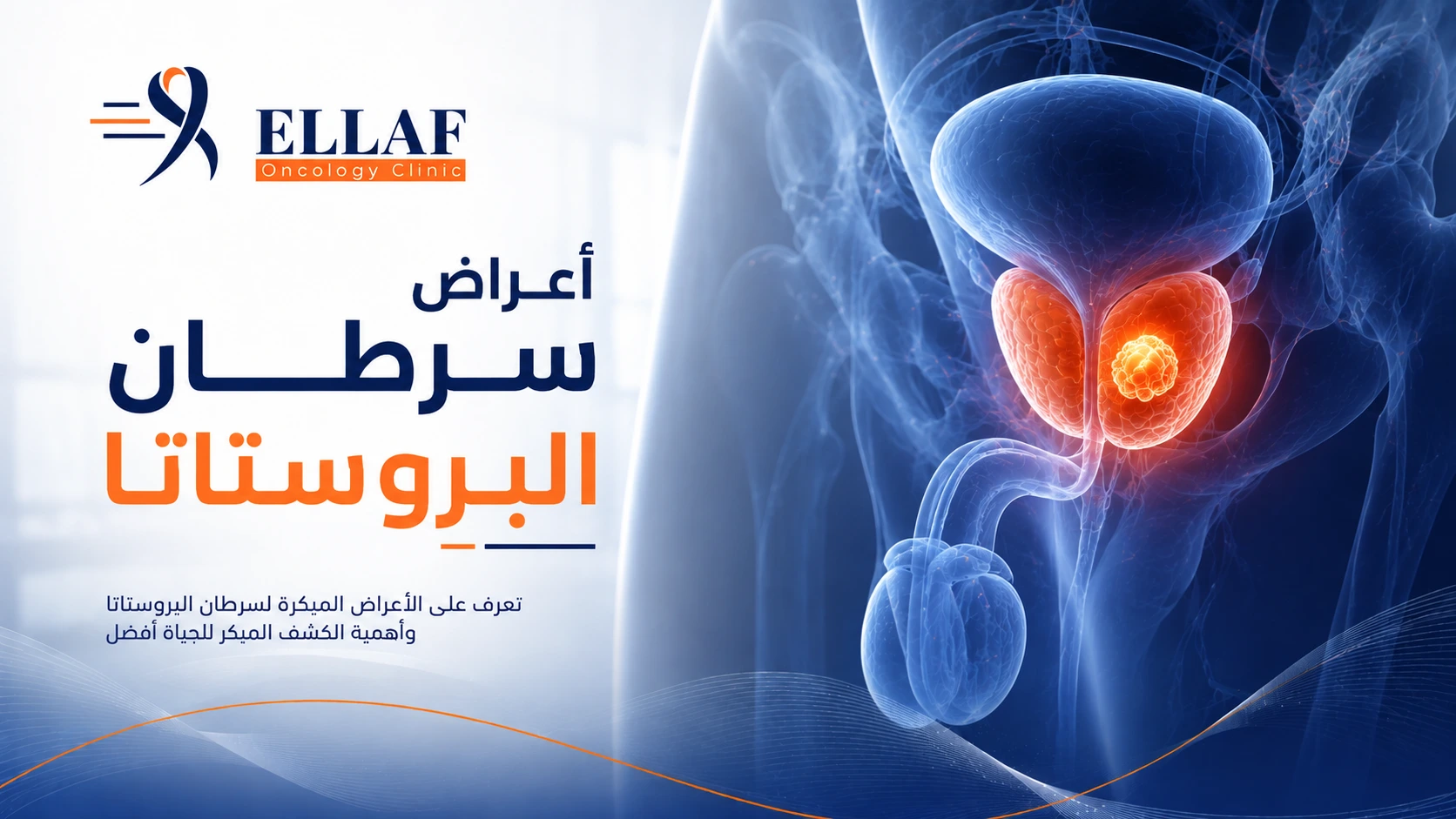 أعراض سرطان البروستاتا | أهم العلامات المبكرة ومتى تستشير الطبيب