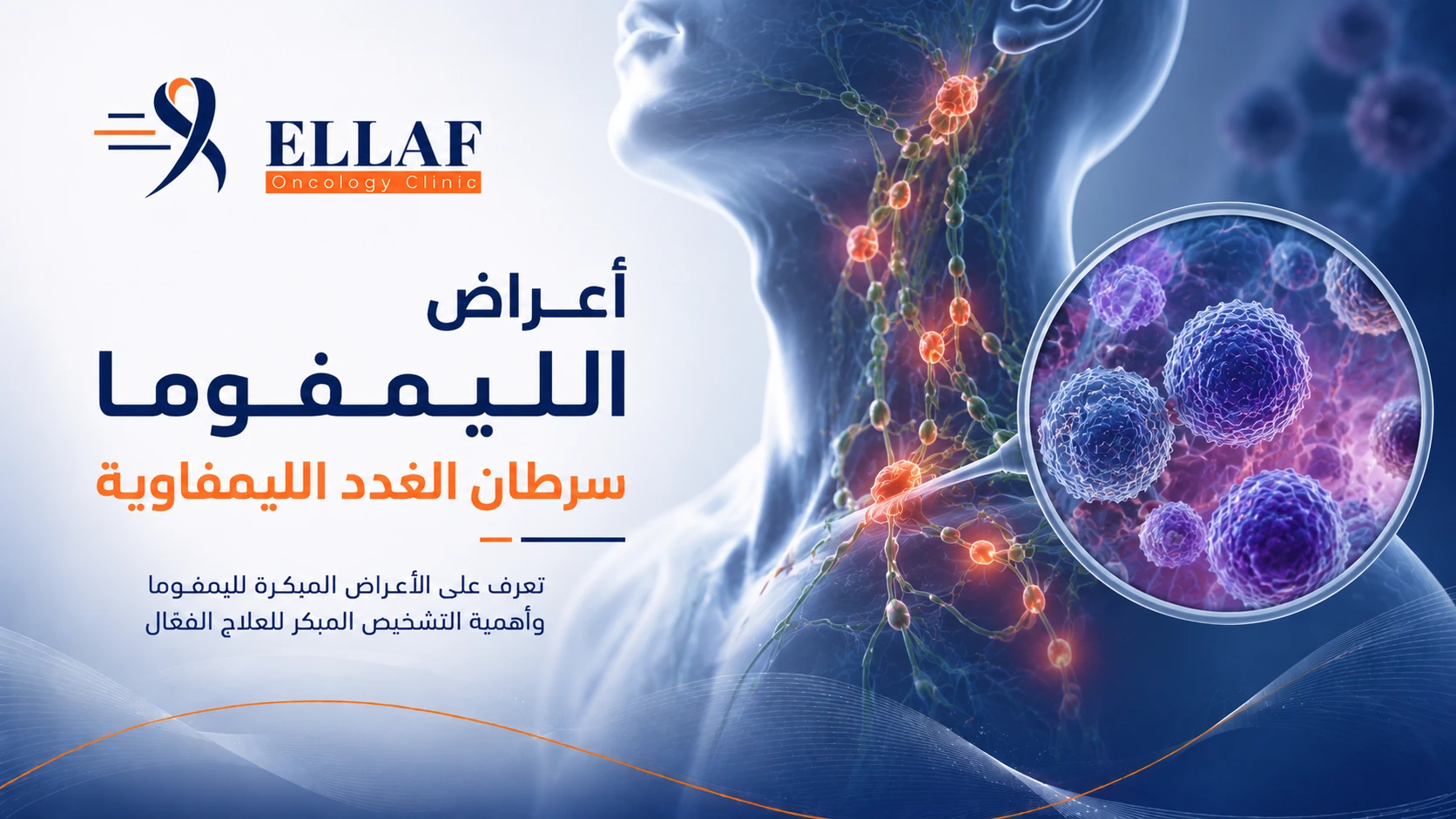 أعراض الليمفوما سرطان الغدد الليمفاوية | العلامات المبكرة